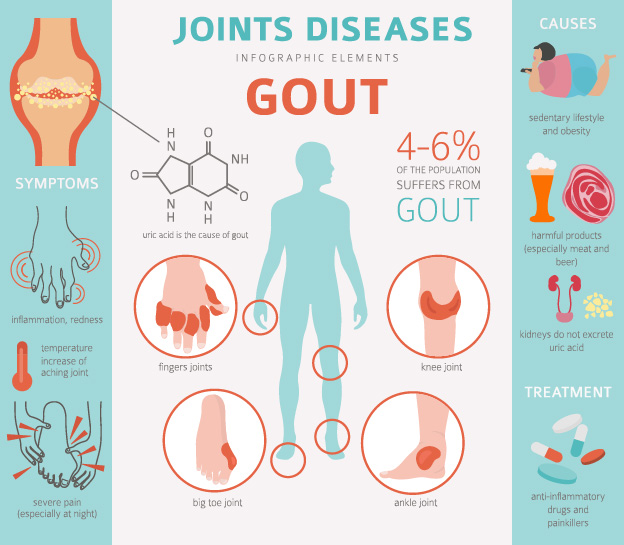 痛风（ Gout）_药得